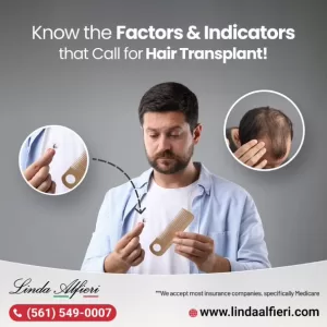 Hair Transplant in boca Raton